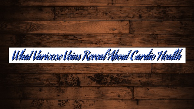 What Varicose Veins Reveal About Cardio Health